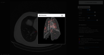 Open Source AI Model for COVID-19 CT Diagnostics and Prognosis